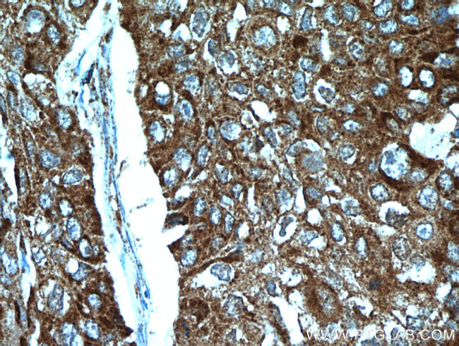 STOML2 Antibody in Immunohistochemistry (Paraffin) (IHC (P))