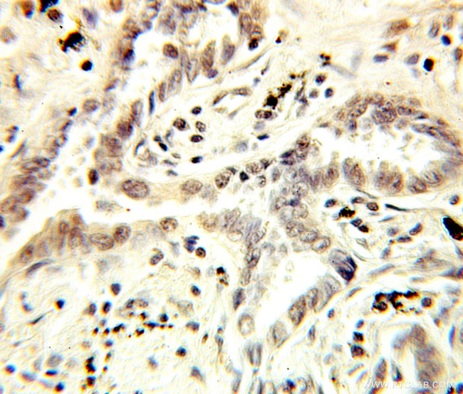 NCBP1 Antibody in Immunohistochemistry (Paraffin) (IHC (P))