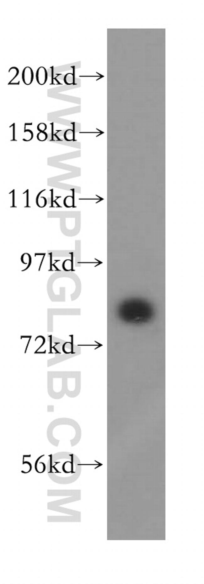 NCBP1 Antibody in Western Blot (WB)