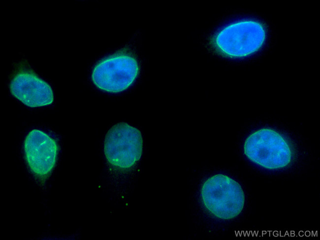 Emerin Antibody in Immunocytochemistry (ICC/IF)