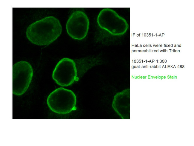 Emerin Antibody in Immunocytochemistry (ICC/IF)