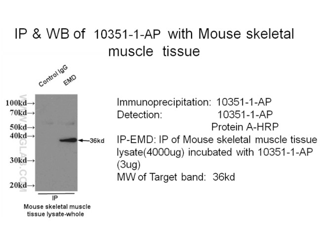 Emerin Antibody in Immunoprecipitation (IP)