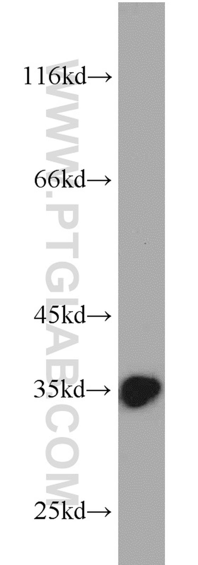 Emerin Antibody in Western Blot (WB)