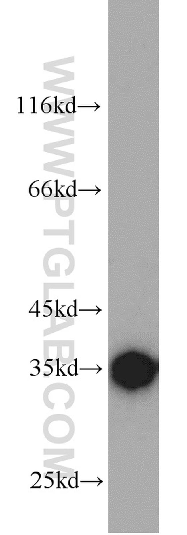 Emerin Antibody in Western Blot (WB)