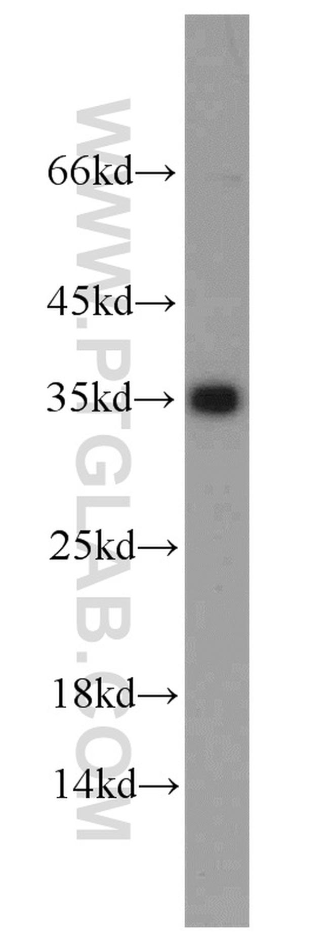 Emerin Antibody in Western Blot (WB)