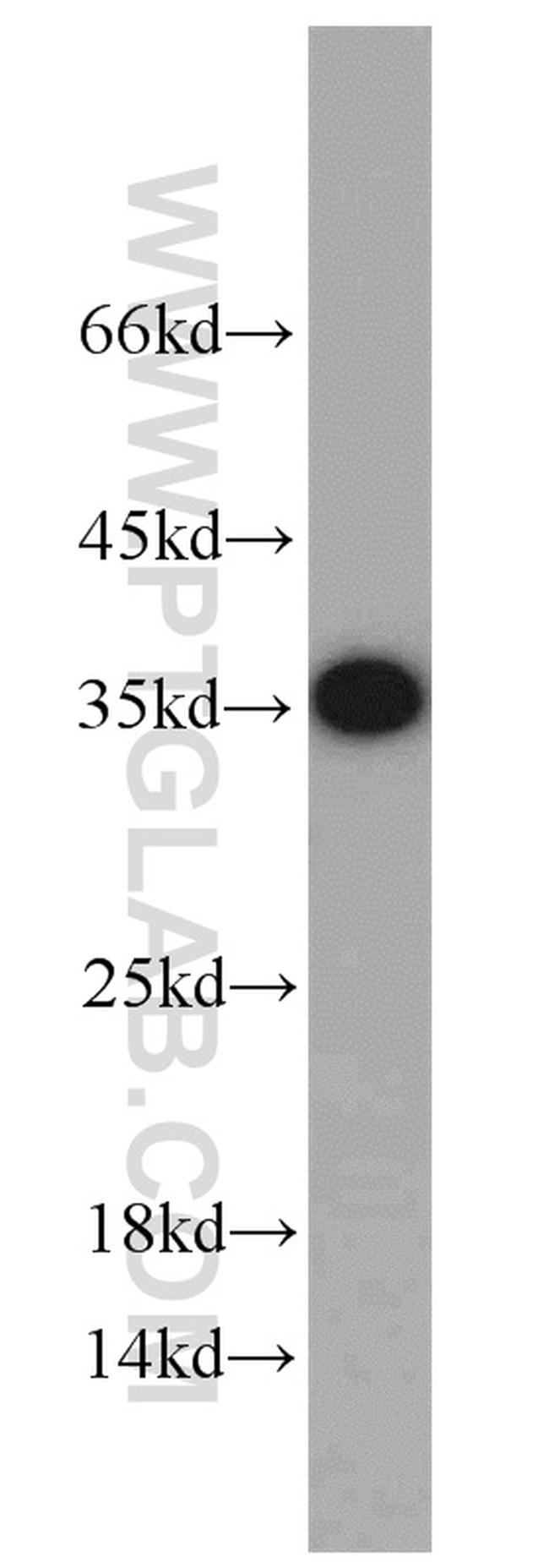 Emerin Antibody in Western Blot (WB)