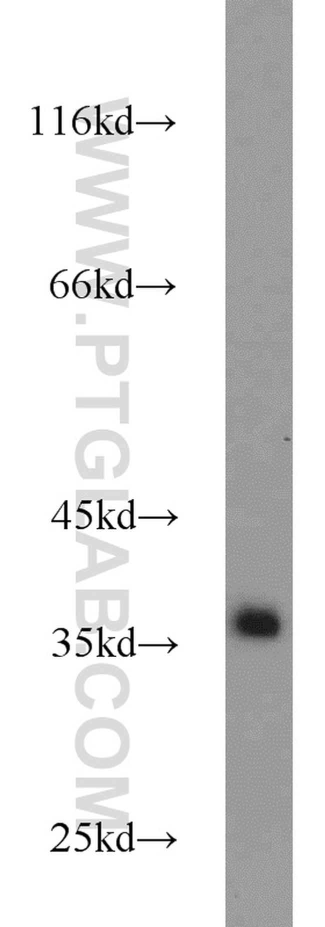 Emerin Antibody in Western Blot (WB)