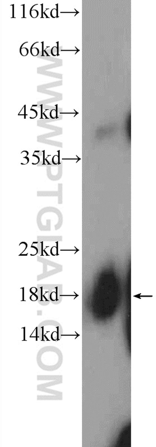 SNRPD1 Antibody in Western Blot (WB)