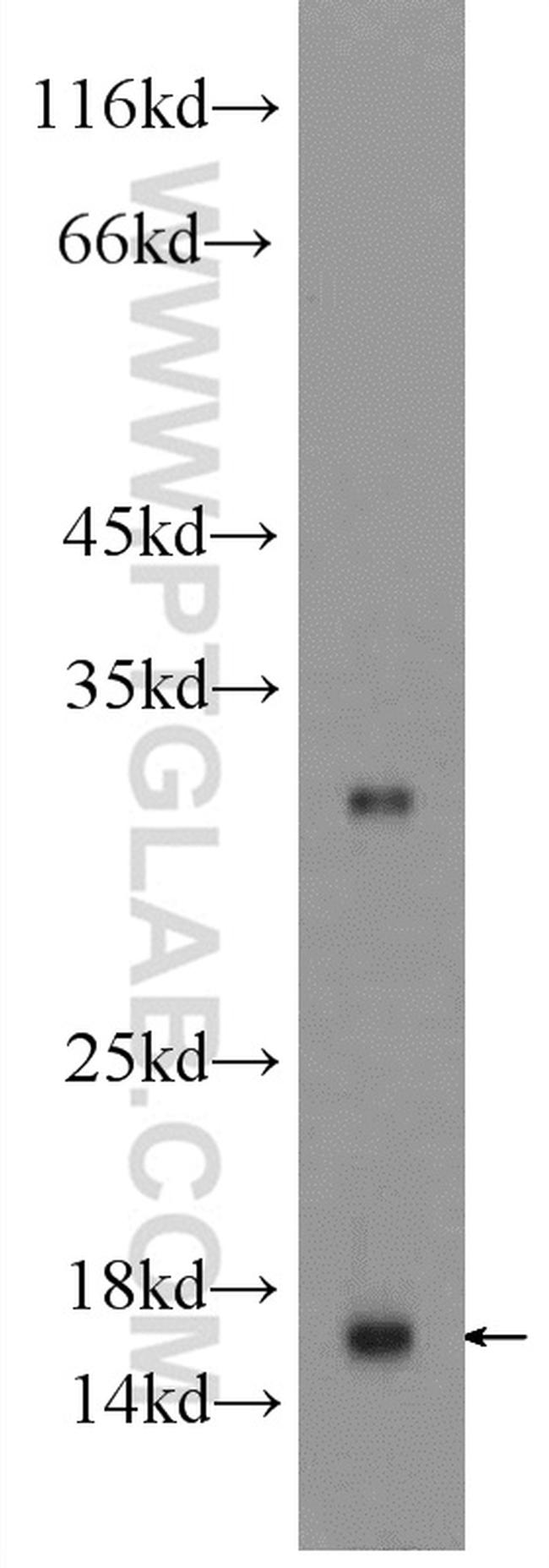 SNRPD1 Antibody in Western Blot (WB)