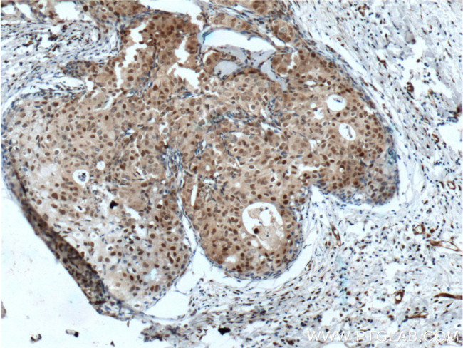 P21 Antibody in Immunohistochemistry (Paraffin) (IHC (P))