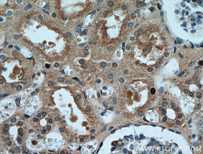 P21 Antibody in Immunohistochemistry (Paraffin) (IHC (P))