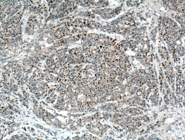 P21 Antibody in Immunohistochemistry (Paraffin) (IHC (P))