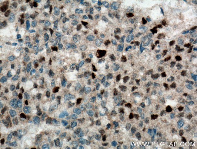 P21 Antibody in Immunohistochemistry (Paraffin) (IHC (P))