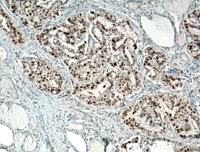 P21 Antibody in Immunohistochemistry (Paraffin) (IHC (P))