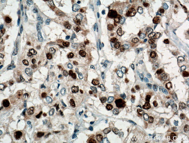 P21 Antibody in Immunohistochemistry (Paraffin) (IHC (P))