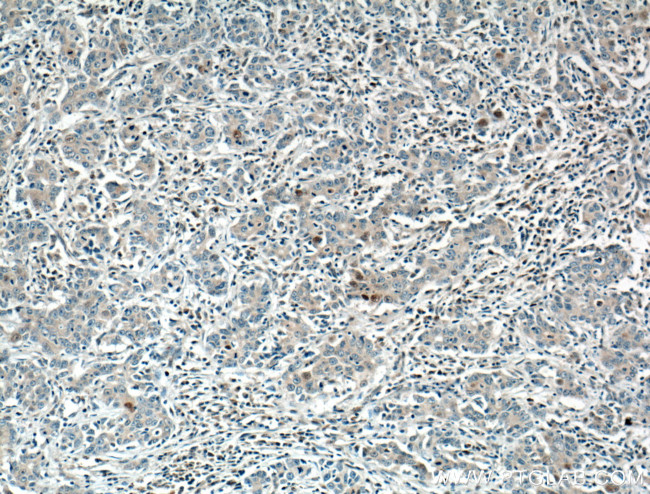 P21 Antibody in Immunohistochemistry (Paraffin) (IHC (P))