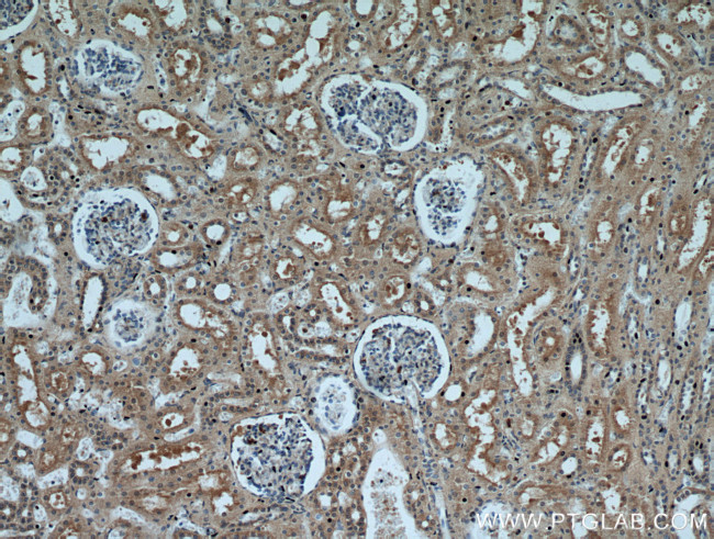 P21 Antibody in Immunohistochemistry (Paraffin) (IHC (P))