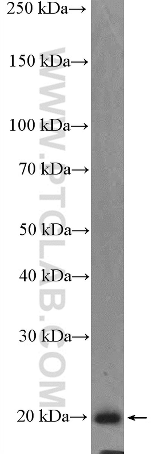 P21 Antibody in Western Blot (WB)