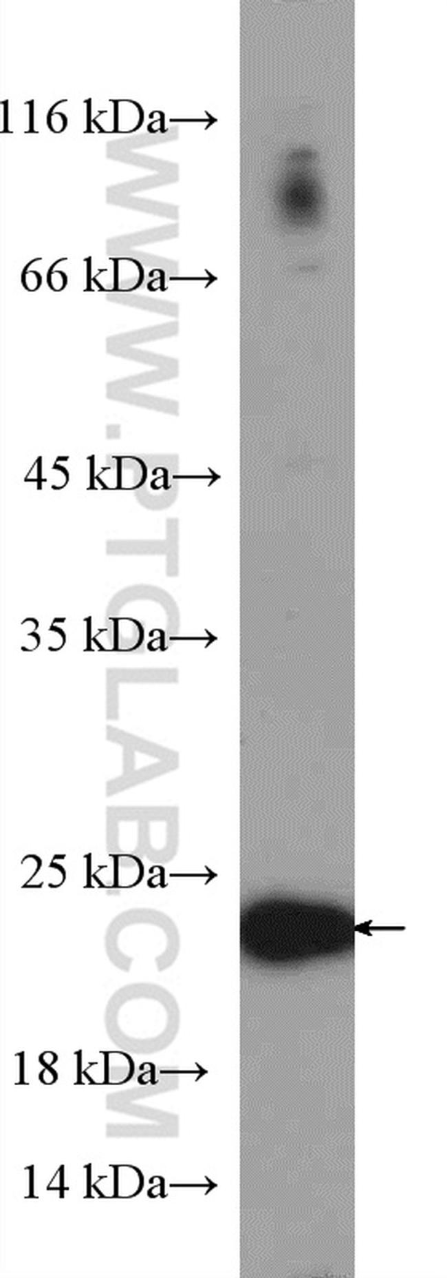 P21 Antibody in Western Blot (WB)