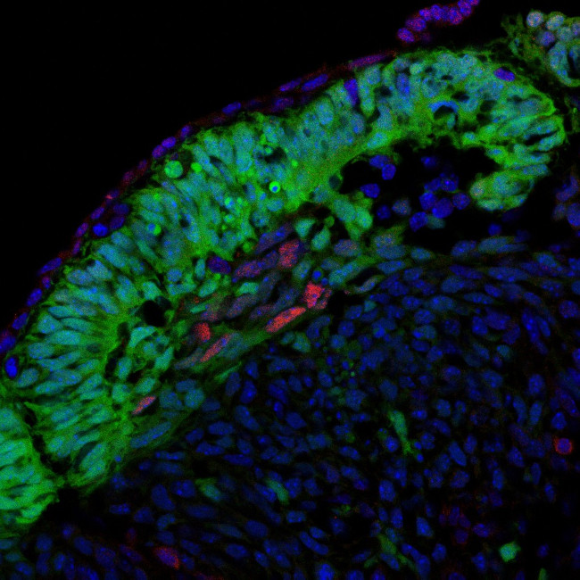 P21 Antibody in Immunocytochemistry (ICC/IF)