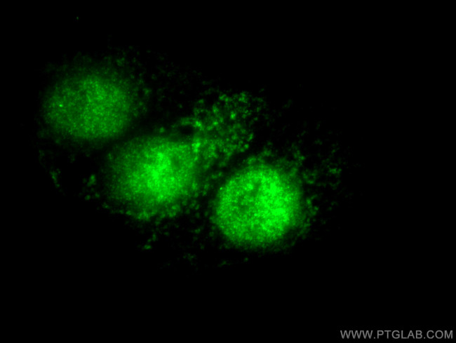 P21 Antibody in Immunocytochemistry (ICC/IF)