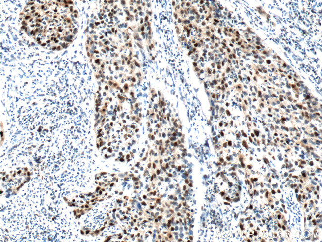 P21 Antibody in Immunohistochemistry (Paraffin) (IHC (P))