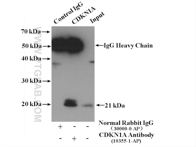 P21 Antibody in Immunoprecipitation (IP)