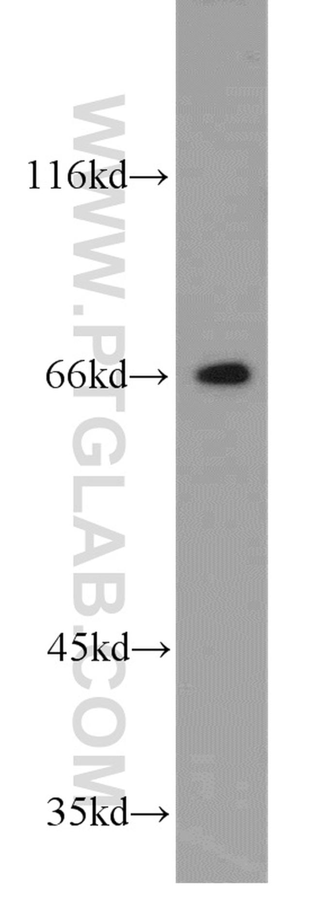 GGA2 Antibody in Western Blot (WB)