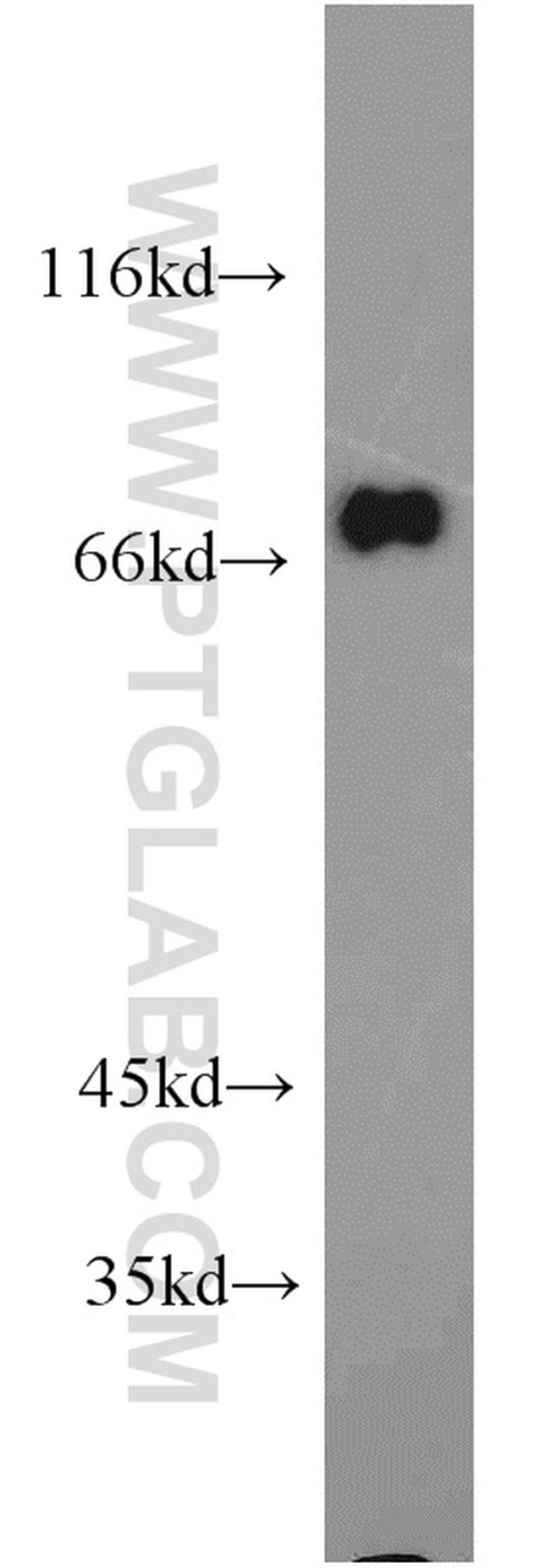 GGA2 Antibody in Western Blot (WB)