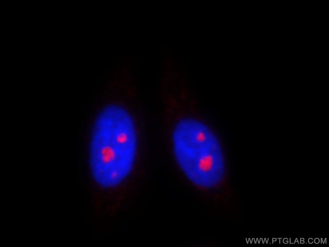 DDX50 Antibody in Immunocytochemistry (ICC/IF)