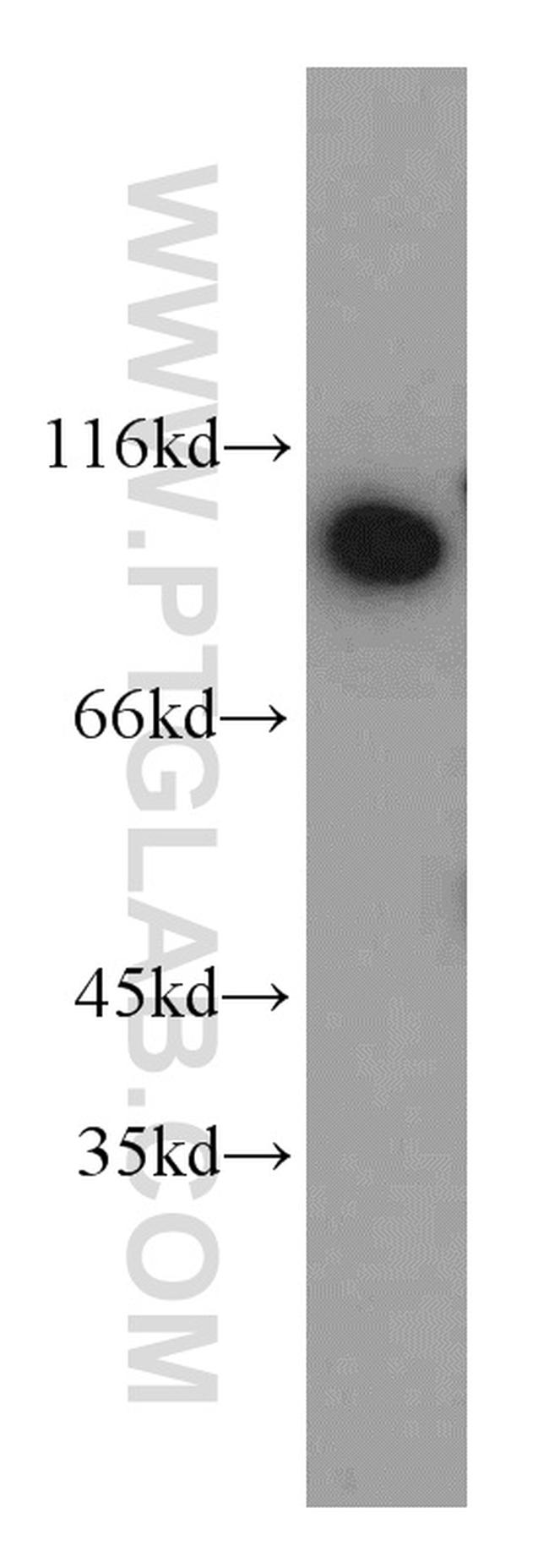 DDX50 Antibody in Western Blot (WB)