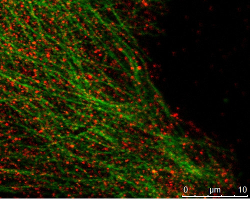 MAPRE2 Antibody in Immunocytochemistry (ICC/IF)