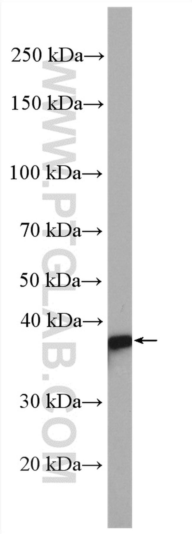 MAPRE2 Antibody in Western Blot (WB)