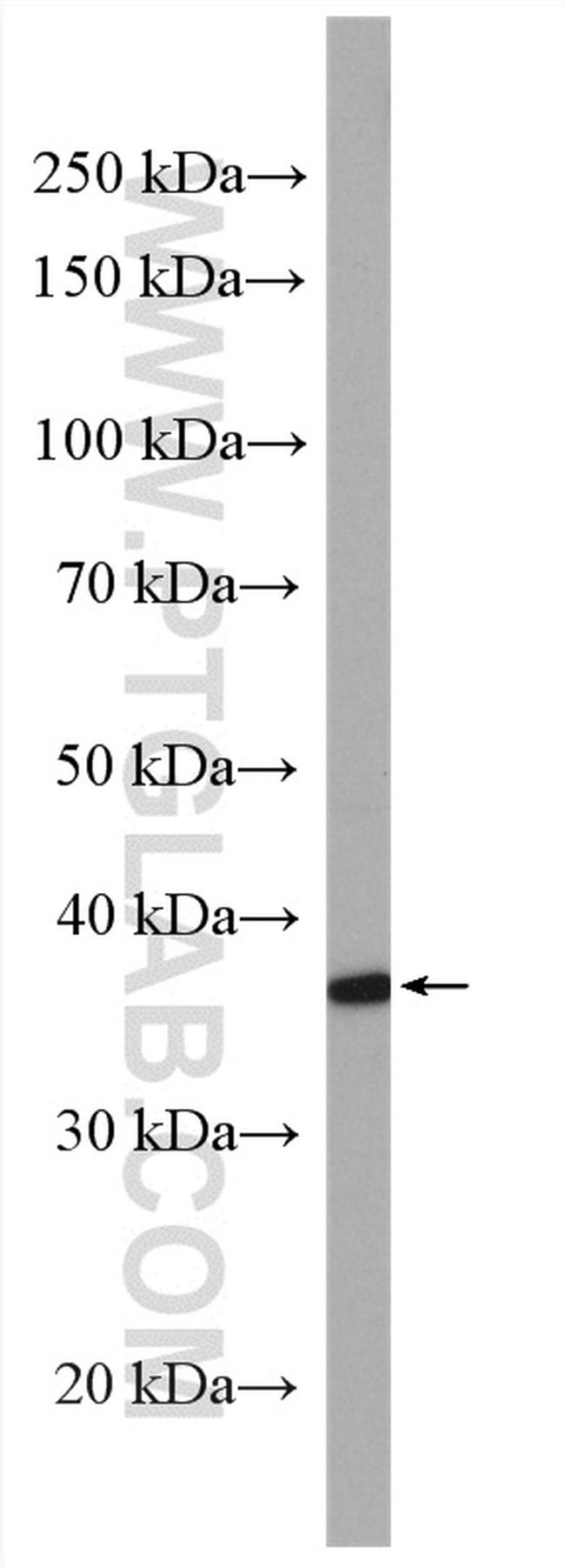 MAPRE2 Antibody in Western Blot (WB)