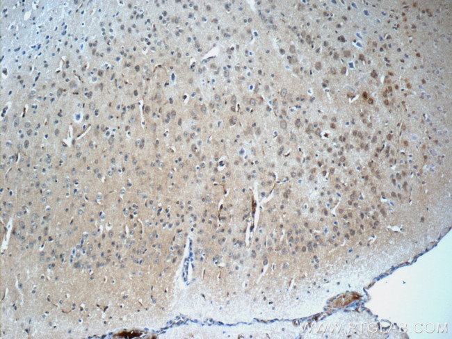 DKK3 Antibody in Immunohistochemistry (Paraffin) (IHC (P))