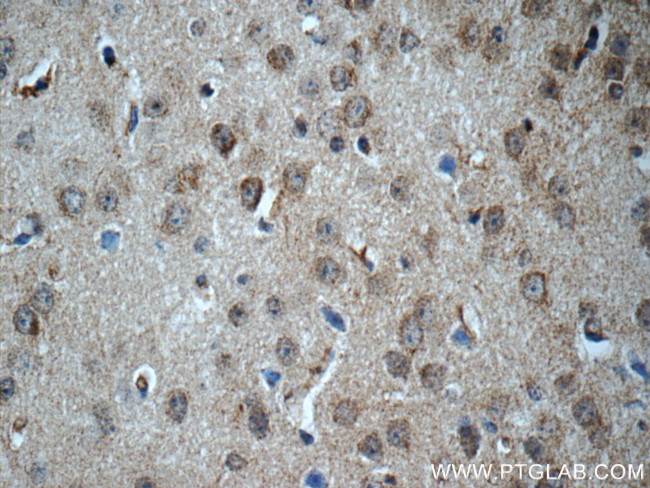 DKK3 Antibody in Immunohistochemistry (Paraffin) (IHC (P))