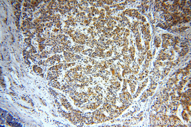 DKK3 Antibody in Immunohistochemistry (Paraffin) (IHC (P))