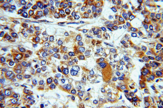 DKK3 Antibody in Immunohistochemistry (Paraffin) (IHC (P))