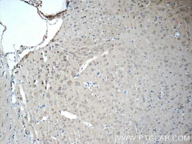 DKK3 Antibody in Immunohistochemistry (Paraffin) (IHC (P))