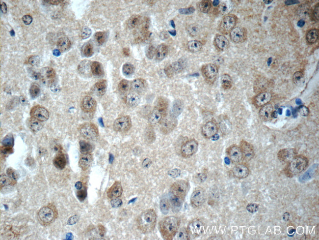 DKK3 Antibody in Immunohistochemistry (Paraffin) (IHC (P))