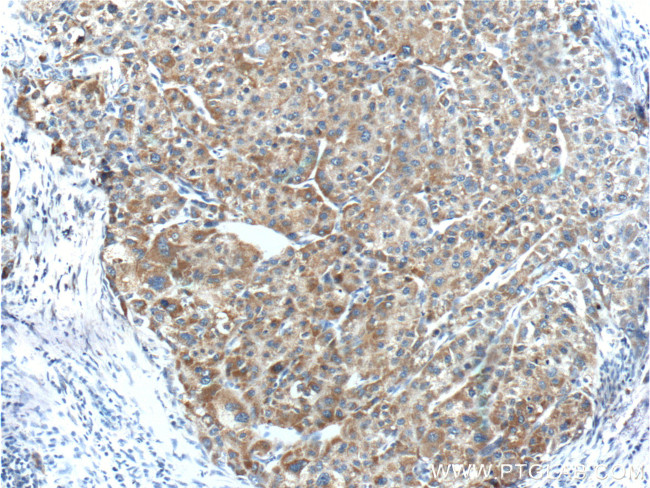 DKK3 Antibody in Immunohistochemistry (Paraffin) (IHC (P))