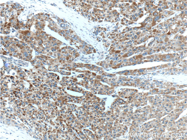 DKK3 Antibody in Immunohistochemistry (Paraffin) (IHC (P))