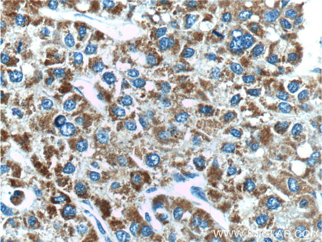 DKK3 Antibody in Immunohistochemistry (Paraffin) (IHC (P))