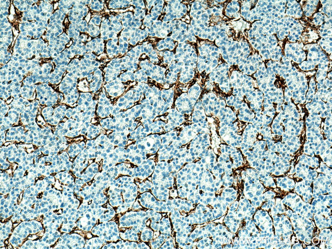 Vimentin Antibody in Immunohistochemistry (Paraffin) (IHC (P))