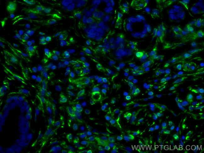 Vimentin Antibody in Immunohistochemistry (PFA fixed) (IHC (PFA))