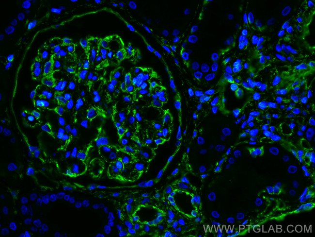 Vimentin Antibody in Immunohistochemistry (PFA fixed) (IHC (PFA))