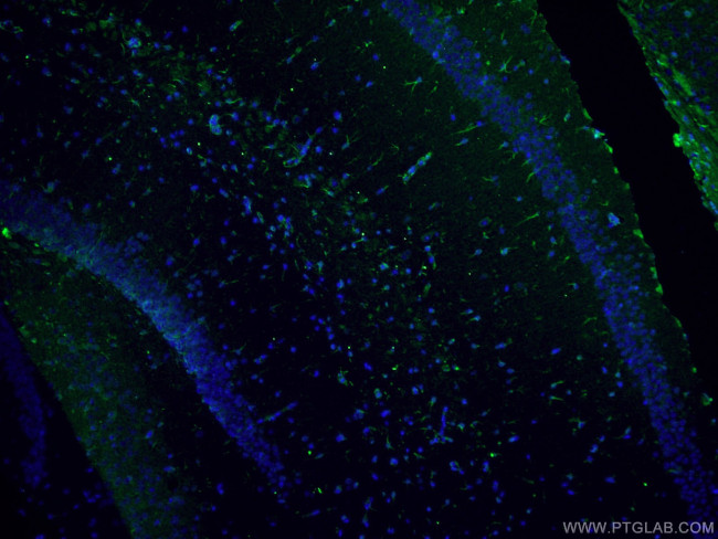 Vimentin Antibody in Immunohistochemistry (PFA fixed) (IHC (PFA))