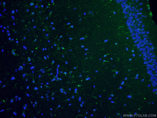 Vimentin Antibody in Immunohistochemistry (PFA fixed) (IHC (PFA))