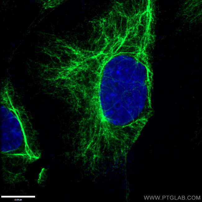 Vimentin Antibody in Immunocytochemistry (ICC/IF)