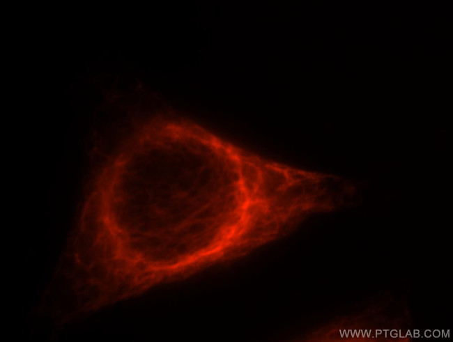 Vimentin Antibody in Immunocytochemistry (ICC/IF)